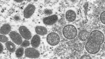 WHO plans to rename monkeypox after critics raised stigmatisation concerns