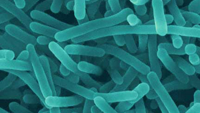 (Listeria)