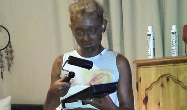 The woman left so dark, she says she was left the same colour "as a dining table" (Supplied)
