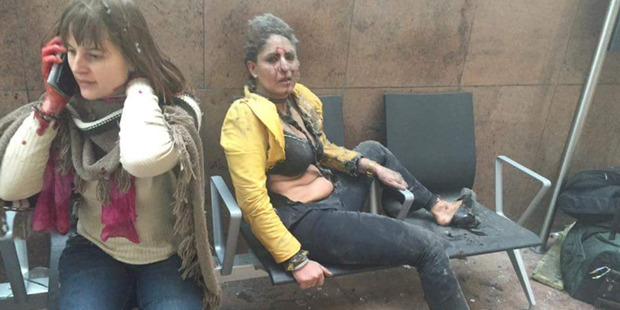 Several people have been injured in the blasts (Photo: GIORGI TABAGARI)