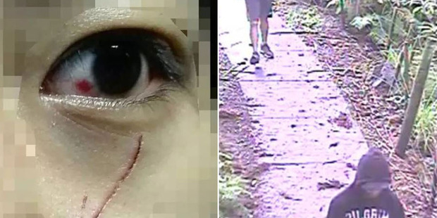Left, One victim was left with a deep cut under her eye after an attack in Albert Park. Right, CCTV footage shows the offenders in an attack near Unitec in Mt Albert.