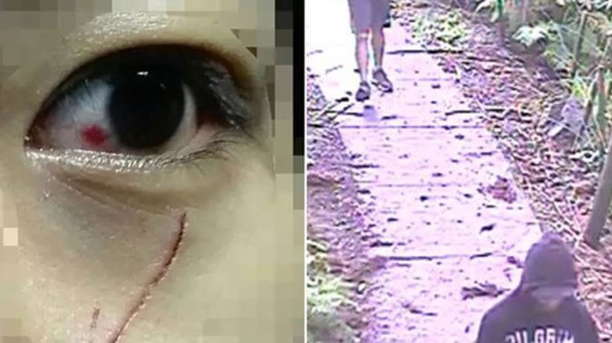 Left, One victim was left with a deep cut under her eye after an attack in Albert Park. Right, CCTV footage shows the offenders in an attack near Unitec in Mt Albert.