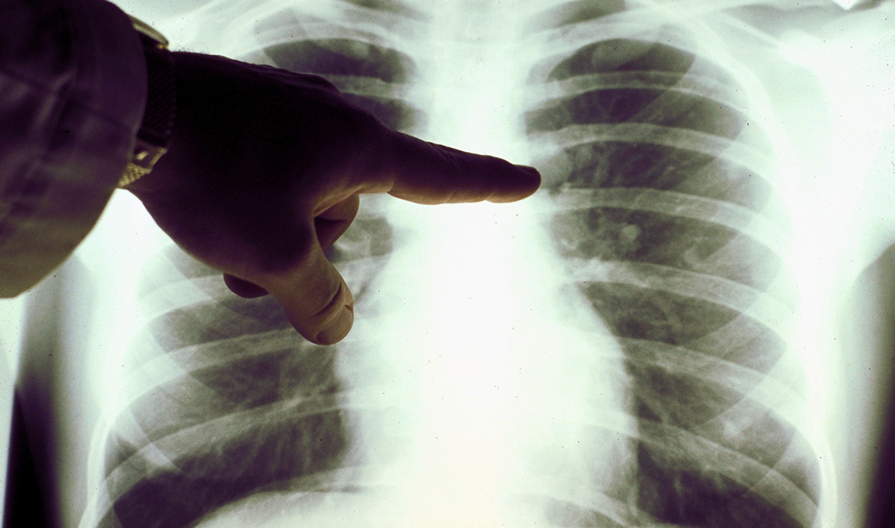 Kerre Woodham: Beyond the headlines of the cancer report