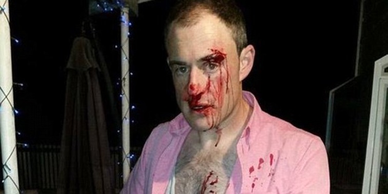 Kent Morgan was attacked as he walked home from work because he was wearing a pink shirt (Kent Morgan).