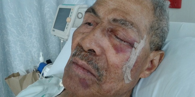Aupito Pupu Lolesio, 79, suffered a bad gash after a fall at his local gym in Manukau on Tuesday. (Supplied).