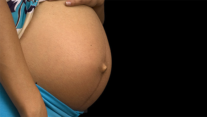 Pregnant women (SXC) 