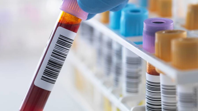Blood tests showed signs of prostate cancer for more than a year before the patient was told. (Photo \ File)