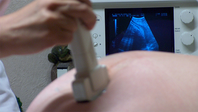 The sonographer was found to have not followed the correct procedures. Photo/SXC