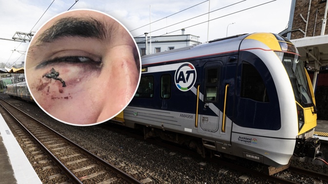 Anthony Nein was attacked by a gang of youths on an Eastern Line train in Auckland and had his headphones, worth $500, stolen. Photo / Supplied