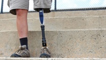 Driver's prosthetic leg gets stuck on accelerator, causes crash