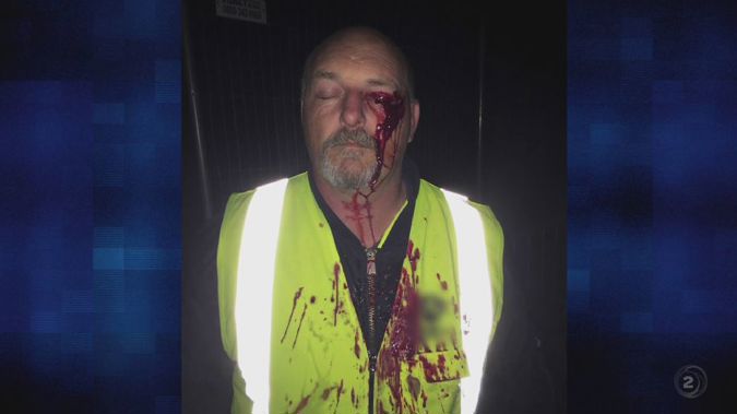 Terry the security guard was attacked at the end of Cup Week. (Photo / TVNZ2)