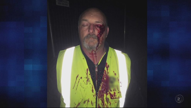 Terry the security guard was attacked at the end of Cup Week. (Photo / TVNZ2)