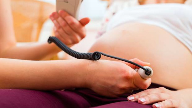 Auckland's DHBs are unsure why emergency c-sections are increasing but have speculated the midwife shortage may be partly to blame. Photo / 123RF