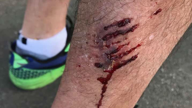 Aaron Keown dog attack (Photo \ Supplied)