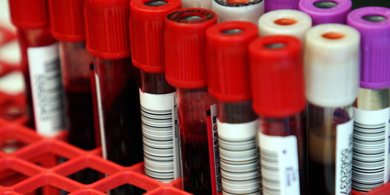 The number of cases reported in 2017 doubled from 2015. (Photo / File)