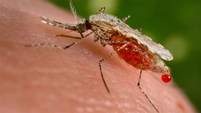 Australia is battling a flesh-eating bug which causes an infectious disease called the Buruli ulcer. (Photo / Public Domain)