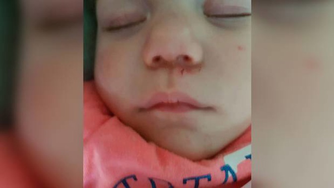 Ava-Rose pictured a few hours after her mum Sarah Jacobson picked her up from Little Monkeys Preschool yesterday. (Photo / Supplied)