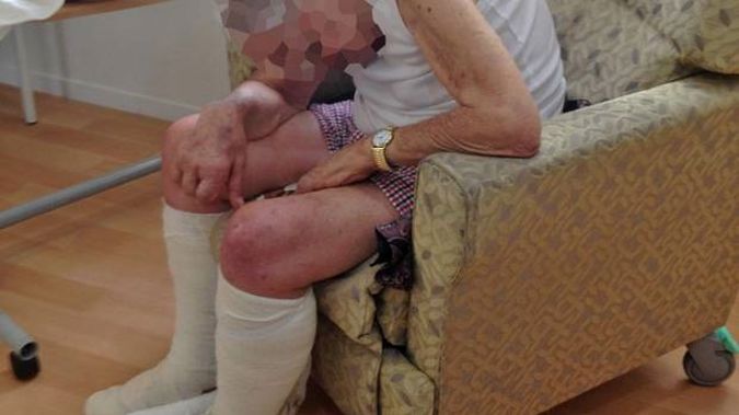 How Evan's family say they found him after he had his feet and leg wounds treated. (Photo / Supplied)