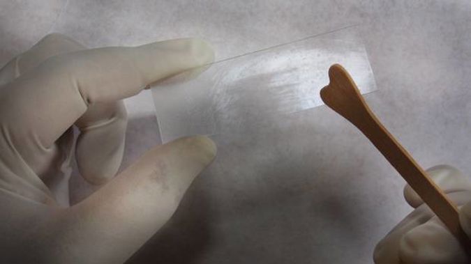 A major improvement to screening for cervical cancer has been delayed. (Photo / Hawke's Bay Today)