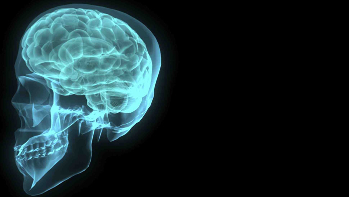 Brain scan for concussion (Photo \ SXC) 
