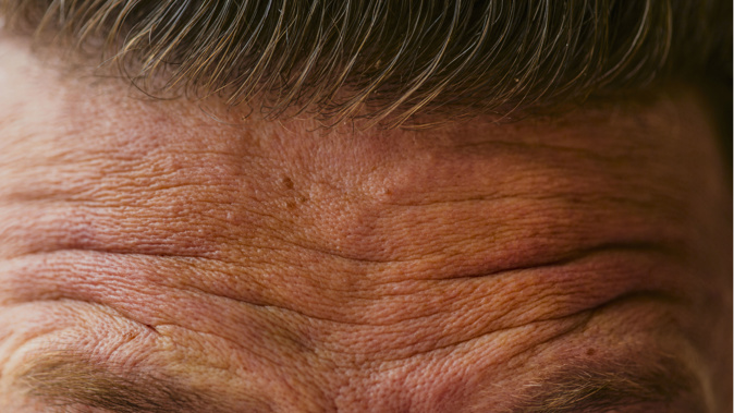 A new study has analysed the foreheads of over 3000 adults. (Photo / Getty)