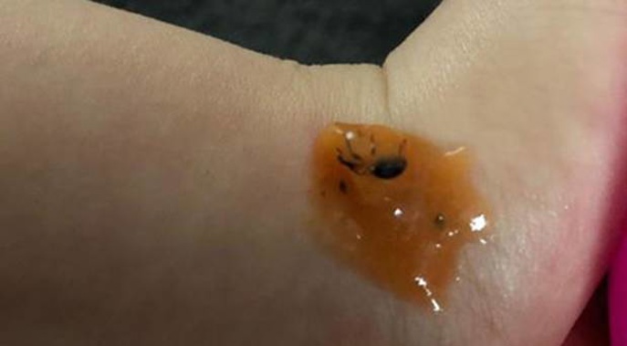 "I was feeling so sick to my stomach. You just don't expect that type of stuff in baby food." (Photo / Supplied)