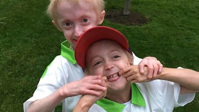 Nathan and Bennett Falcone are the playful brothers bringing their community in Pennsylvania together to fight for research into progeria. (Photo / Facebook)