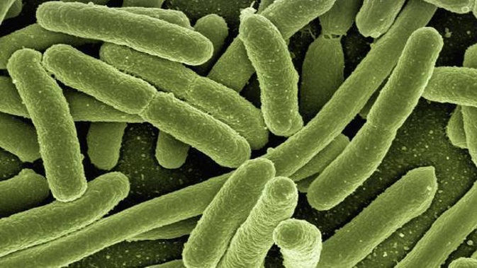 The genes for resistance to carbapenem antibiotics have spread to some strains of E. coli bacteria. Image / Pixabay