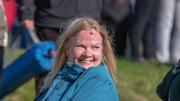 A spectator who was hit with Tyrell Hatton's tee shot at the 15th hole is taken by buggy back to the medical centre for treatment. Photo / AP