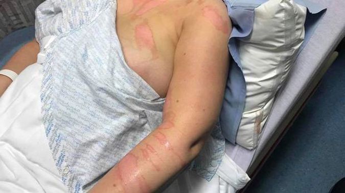 The nurse's injuries are believed to have been caused by a patient. (Photo / Facebook)