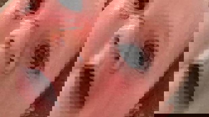 Noah - four months old - suffers horrific blister burns after Cancer Society 50 SPF sunblock fails to protect him from NZ's harsh rays. Photo / Supplied