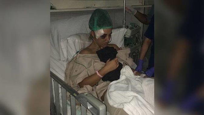New Zealand fitness trainer Kobi Bracken was hospitalised after she was in a horrific motorcycle accident when she was holidaying in Bali. (Photo / Kobi Bracken)