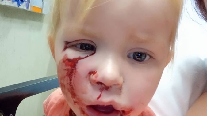 Amelia-Jayne Morphus was attacked by the dog when she went to pat it outside her house. Photo / Supplied.