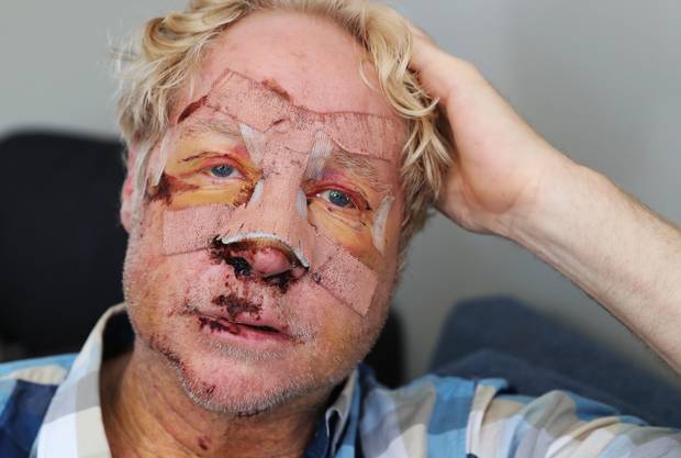 Neville Carpenter is recovering after a horror cycling accident. (Photo / NZ Herald)