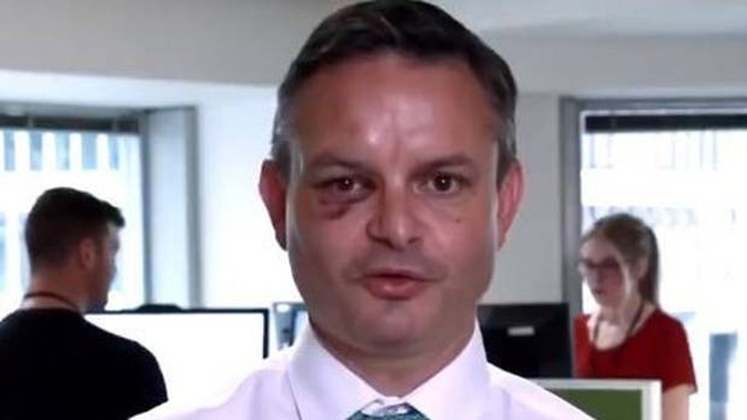 Green Party co-leader James Shaw reveals the extent of his injuries after being attacked. Photo / Twitter vie