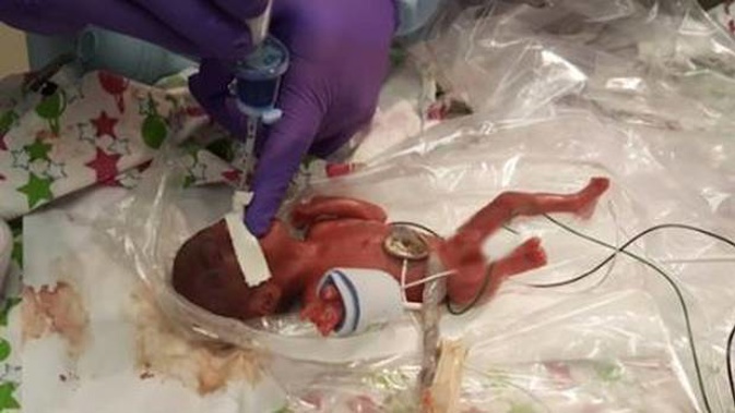 Baby named Saybie was born at 23 weeks and three days. (Photo / Supplied)