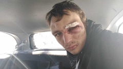 22-year-old Valkerim Miller was brutally assaulted in the back of a stranger's car. (Photo / Supplied)