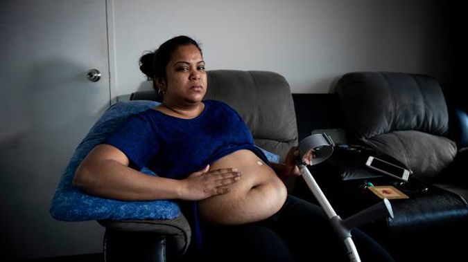 Poonam Nand is in constant pain and has been waiting for months to get treatment for a distended stomach. (Photo / Dean Purcell)
