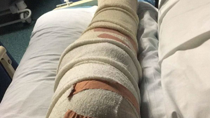 Dylan says he was trying to escape the oncoming road roller. (Photo / File)