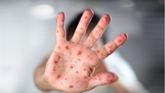 Eight adults and seven children are currently in hospital with the disease.