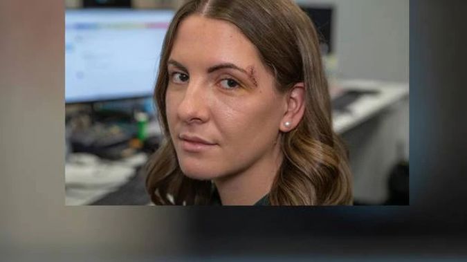 NZ Herald reporter Georgina Campbell in the Wellington newsroom a few days after being injured in Christchurch. (Photo / Mark Mitchell)
