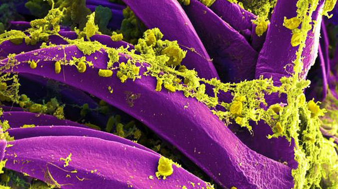 It's the second time the disease has been detected in the region. (Image / National Institute of Allergy Infectious Diseases)