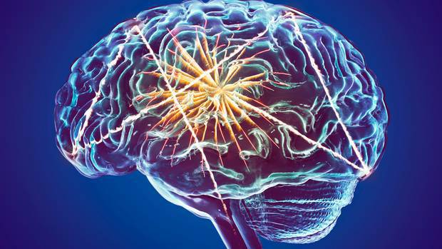 The challenges of combatting dementia as NZ faces potential 'tsunami' of cases - Brainstorming with Clare de Lore
