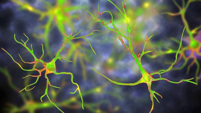 New research has discovered that the star-shaped brain cells called astrocytes play a critical role in controlling blood flow in the brain. Photo / Supplied