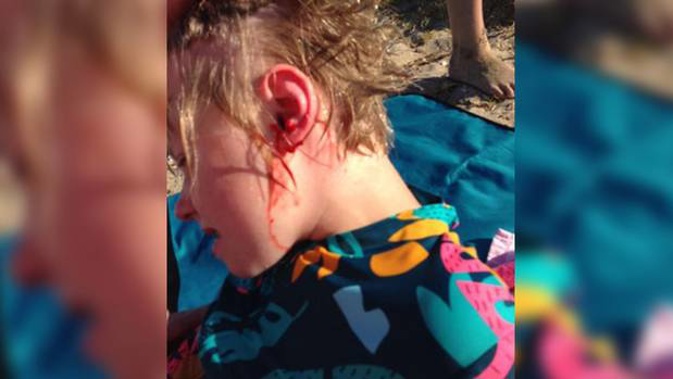 Nine-year-old Christiana Holt was taken to hospital after a dog attacked her on Eastern Beach. Photo / Supplied
