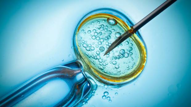 IVF is a process of fertilisation combining egg with sperm outside the body. Photo / 123RF