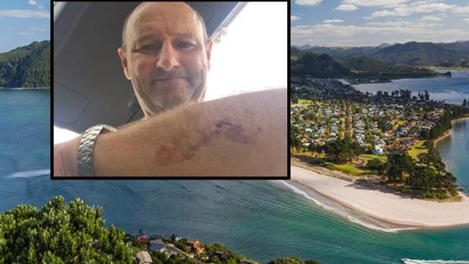Takapuna resident Nick Minogue, 60, was attacked by what he believes was a Great White shark off Pauanui beach which bit his arm and latched onto his surfboard. Photo / Supplied