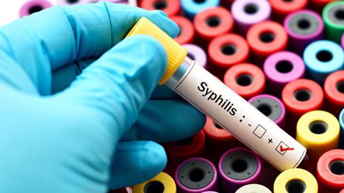 Syphilis is slowly but surely on the rise in New Zealand. Photo / 123rf