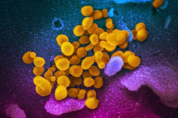 Coronavirus Covid-19 has infected nearly half a million people worldwide, and killed nearly 22,000. Image / US National Institutes of Health