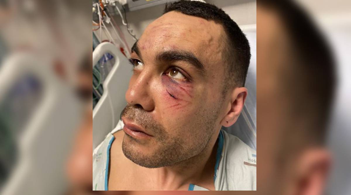 'He's bleeding everywhere' - Witnesses allege police kneed a man in the head after he was caught tagging on a wall. Video / @kaylurrrkid